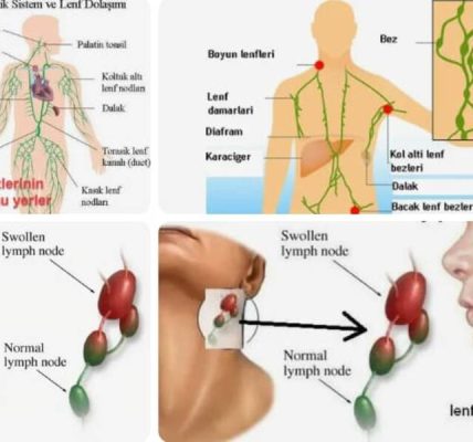 Ablutofobi: Nedir, nasıl ortaya çıkar ve nasıl tedavi edilir??