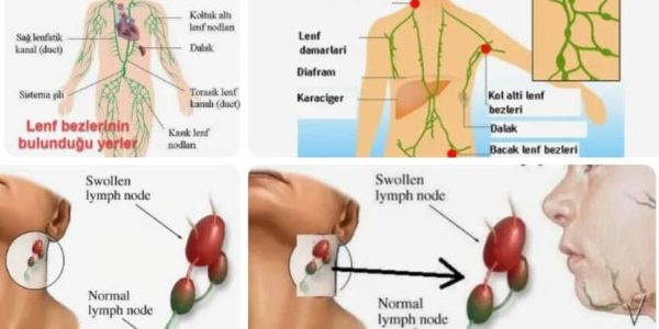 Ablutofobi: Nedir, nasıl ortaya çıkar ve nasıl tedavi edilir??