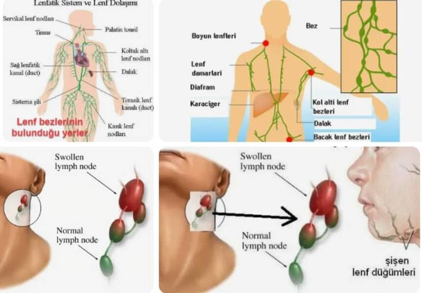 Ablutofobi: Nedir, nasıl ortaya çıkar ve nasıl tedavi edilir??