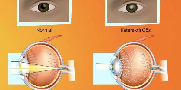 Zoofobi: ortaya çıkış nedenleri, semptomatolojisi ve tedavisi