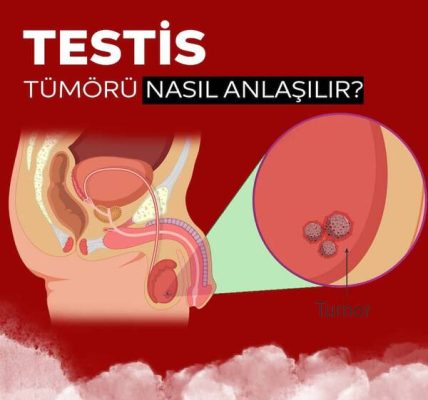 Bir erkeğe 34 yıl için ne verilir??