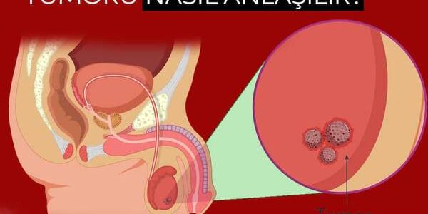 Bir erkeğe 34 yıl için ne verilir??