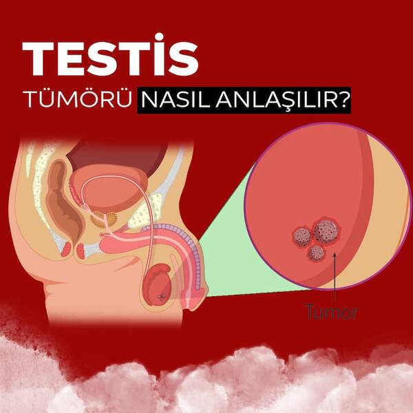Bir erkeğe 34 yıl için ne verilir??